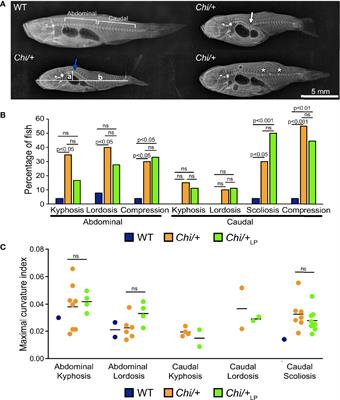 Compression Fractures and Partial Phenotype Rescue With a Low Phosphorus Diet in the Chihuahua Zebrafish Osteogenesis Imperfecta Model